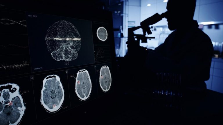 Alzheimer araştırmalarında şok! 16 yıllık makale tartışma yarattı… Yüzlerce çalışma çöpe mi gidecek?