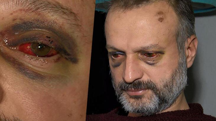 ‘Çiftetelli’ çalmadığı için dövülen müzisyen: Çalışamayacak durumdayım, çok mağdurum