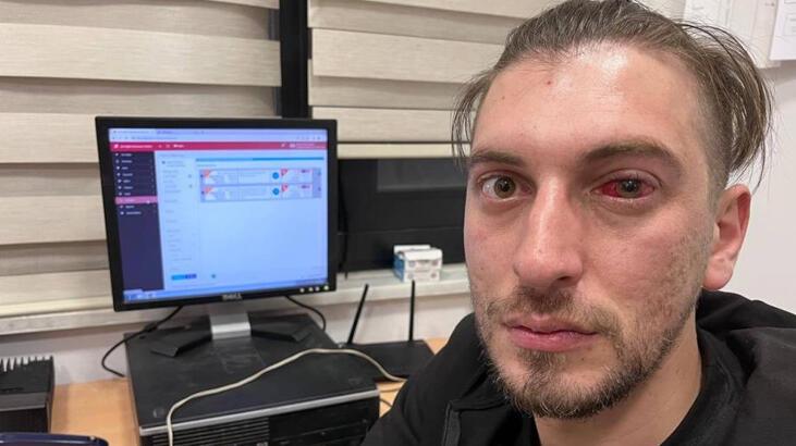 Sağlık çalışanlarına demir sopalı saldırı! ‘Cam gözüme girdi’