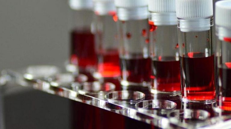 Kan gruplarıyla ilgili korkutan araştırma! Aralarından biri felaket hastalığa karşı çok dirençsiz