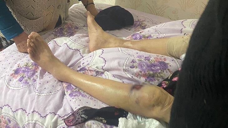 Ankara’da bakıcı dehşeti: 91 yaşındaki yaşlı kadın hastanede ölüm kalım savaşı veriyor