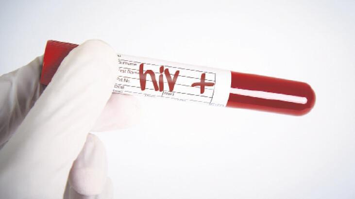 HIV’le mücadelede en büyük eksiklik tanıda