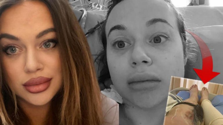 Dizleri üstünde uyuyakaldı, neredeyse bacağını kaybediyordu! Haftalarca hastanede kaldı…