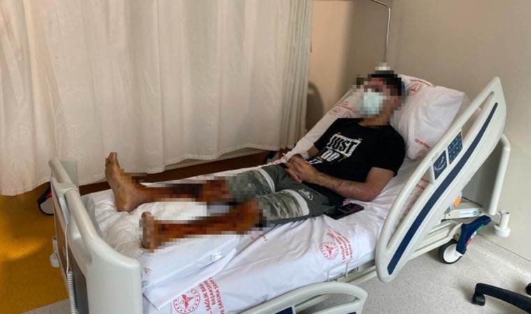 Lavabo açıcı bomba gibi patladı, 21 yaşındaki genç dehşeti yaşadı: ‘Acıyla hastaneye gittim, halime şükrediyorum’