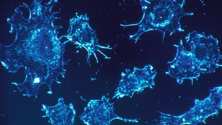 Kanser vakaları 2050 yılında yüzde 77 artacak