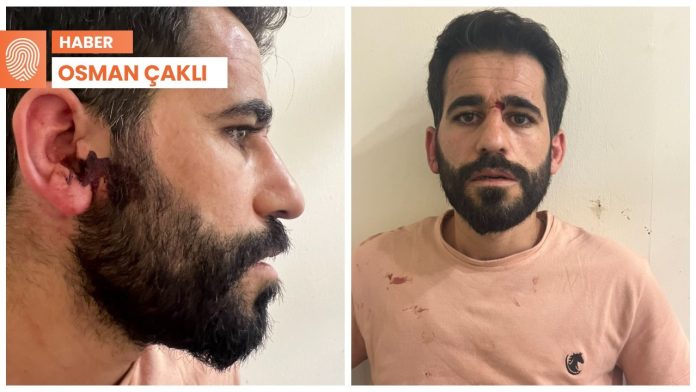 vatan-emniyette-avukatlara-olumcul-dayak-savci-otopsi-icin-gelirim-dedi-3ar4Y5XL.jpg