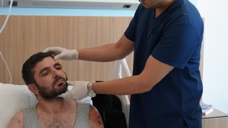 Bacağından alınan dokuyla yeni yüzüne kavuştu