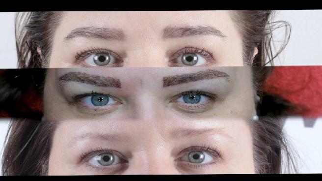 Micro Brow Implant Nedir? 
