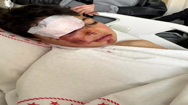 Aksaray’da Bisikletliye Otomobil Çarptı, Sürücü Kaçtı