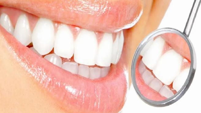 Diş beyazlatmada doğru bilinen yanlışlar!
